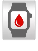 Apple Watch Series 1 Wasserschaden Diagnose